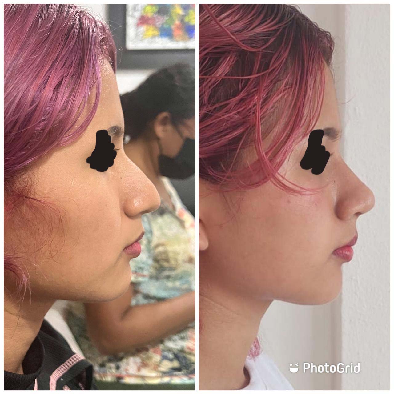 Procedimientos especializados