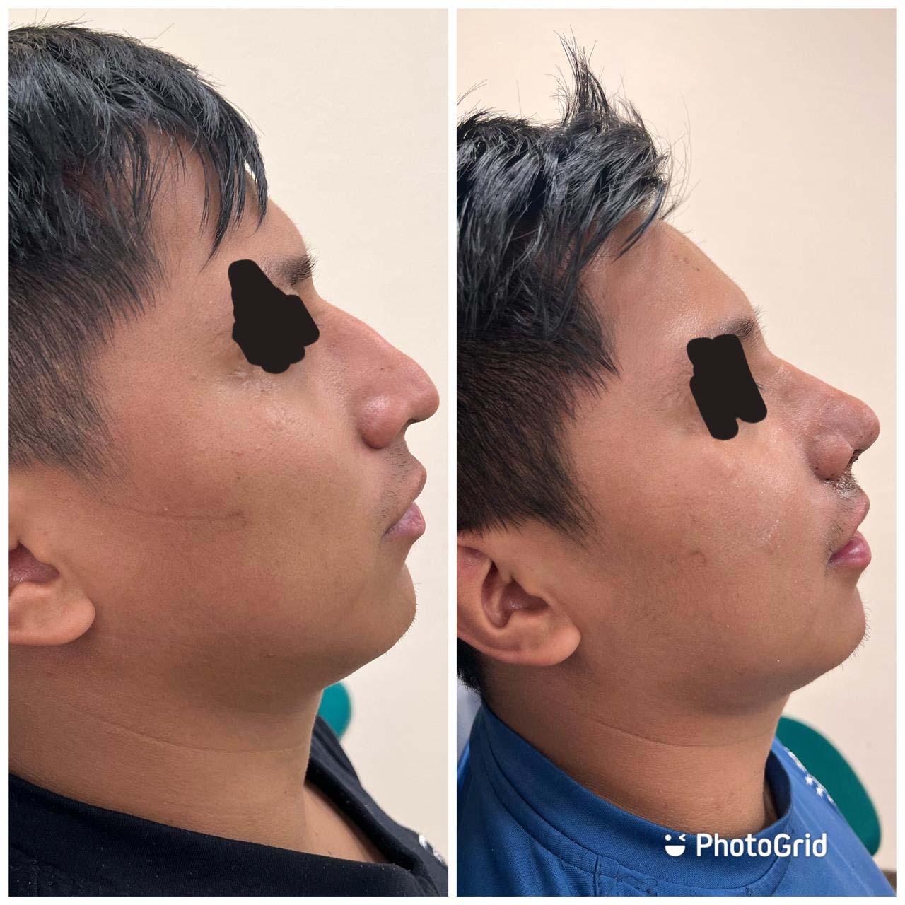 Tecnología endoscópica