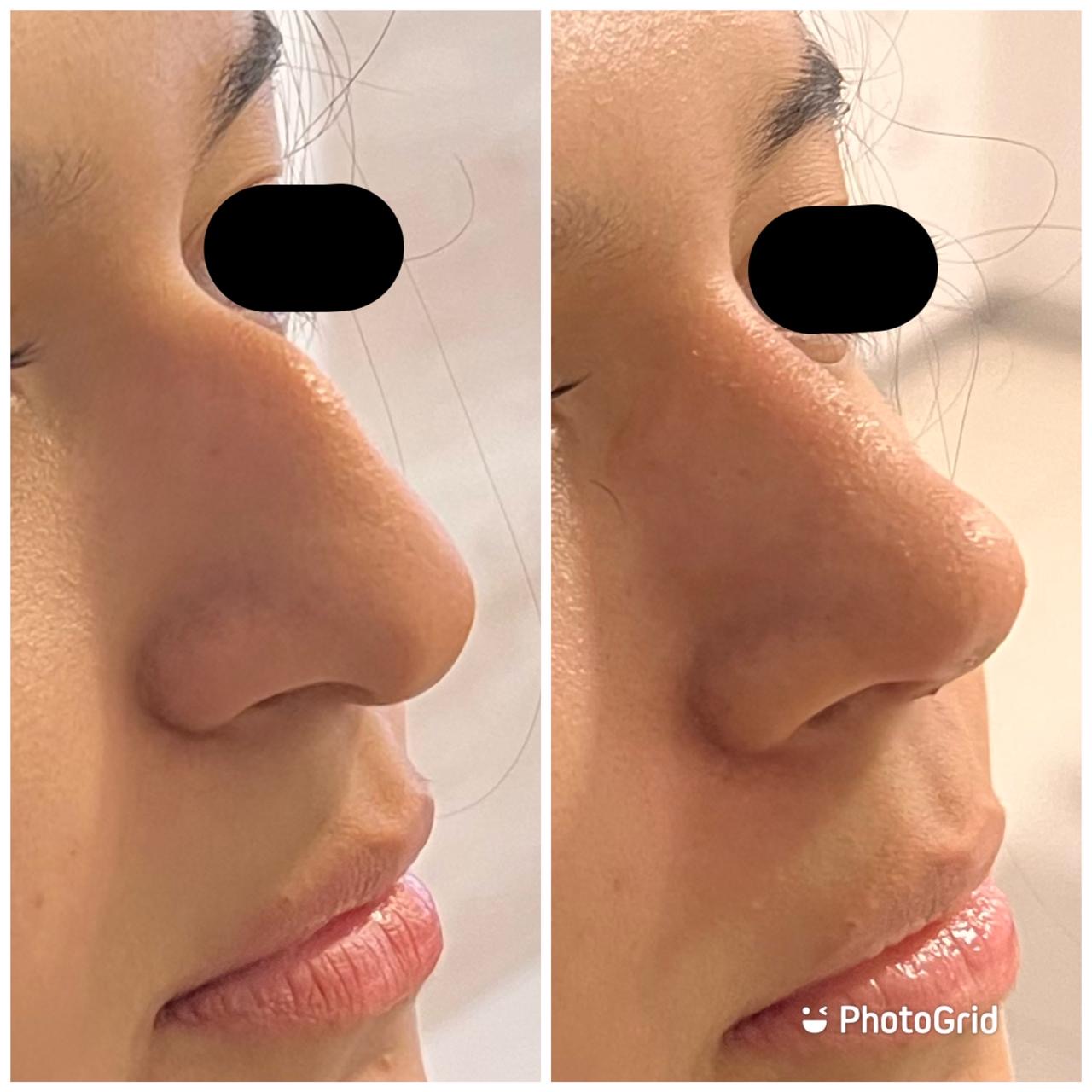 Procedimientos ambulatorios