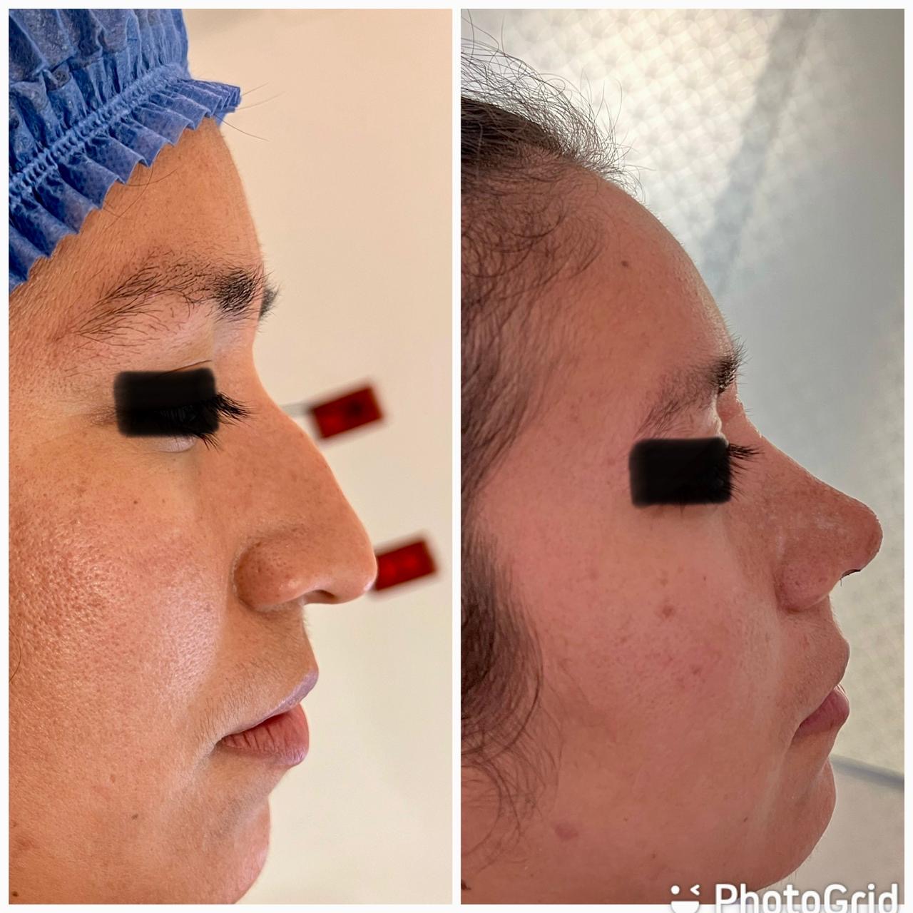 Área de recuperación