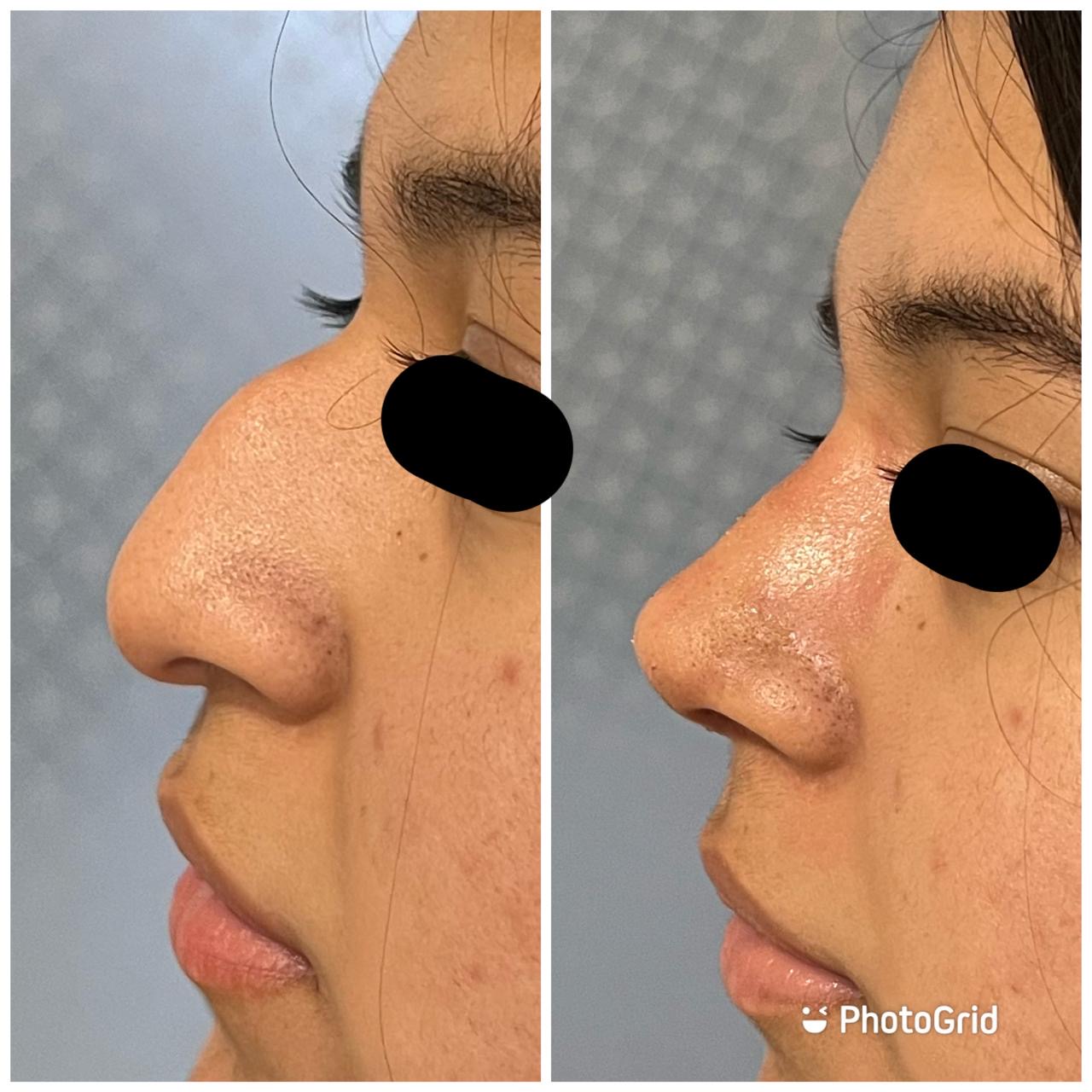 Tecnología ultrasónica