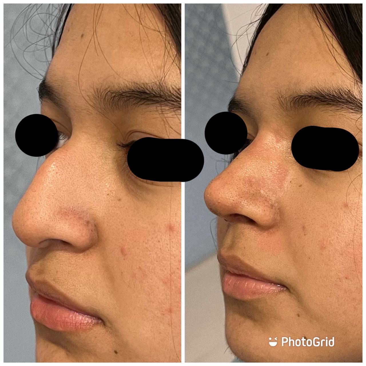 Resultados de tratamientos